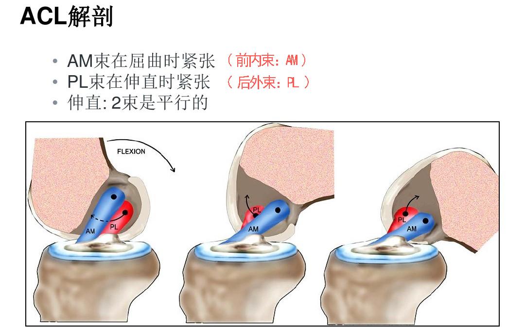 前叉重建单束能够满足运动要求么,前叉重建有几个切口
