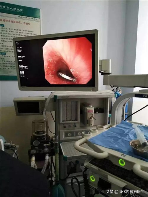 儿童胃痛能吃奥美拉唑吗,小孩胃痛胃胀能够做胃镜吗