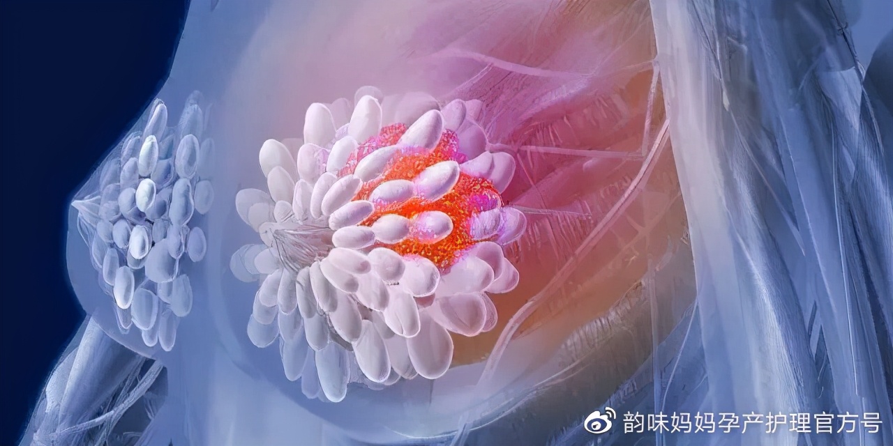 新手宝妈乳房护理,新手妈妈怎么给乳房清洁