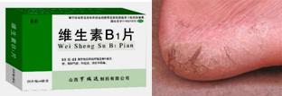 脚气口腔溃疡缺什么维生素,治疗口腔溃疡脚气病的维生素