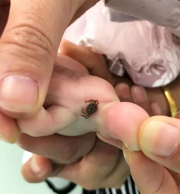 潍坊所有的家长，这种虫子传播新型艾滋病，最喜欢叮咬孩子……