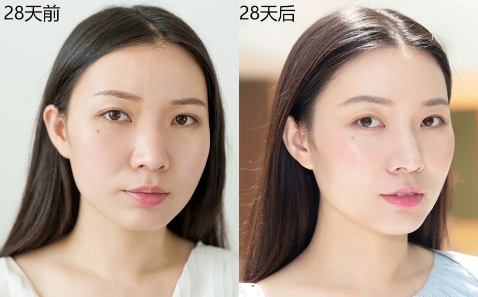 28天解决了所有皮肤问题，你猜我做了些什么？