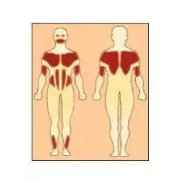 重症肌无力会出现手部肌肉萎缩吗,肌肉萎缩无力确诊不了渐冻症
