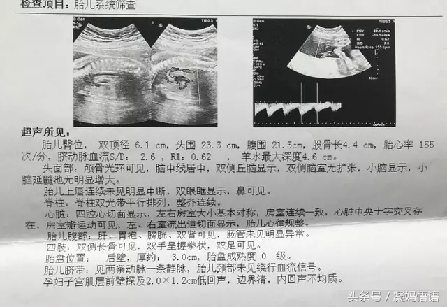 四维大排畸跟小排畸有什么区别,孕期大排畸和小排畸有什么区别吗
