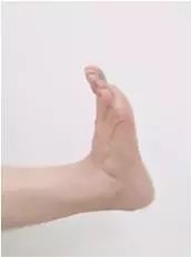 踝关节扭伤有积液怎么治,踝关节扭伤手法复位视频