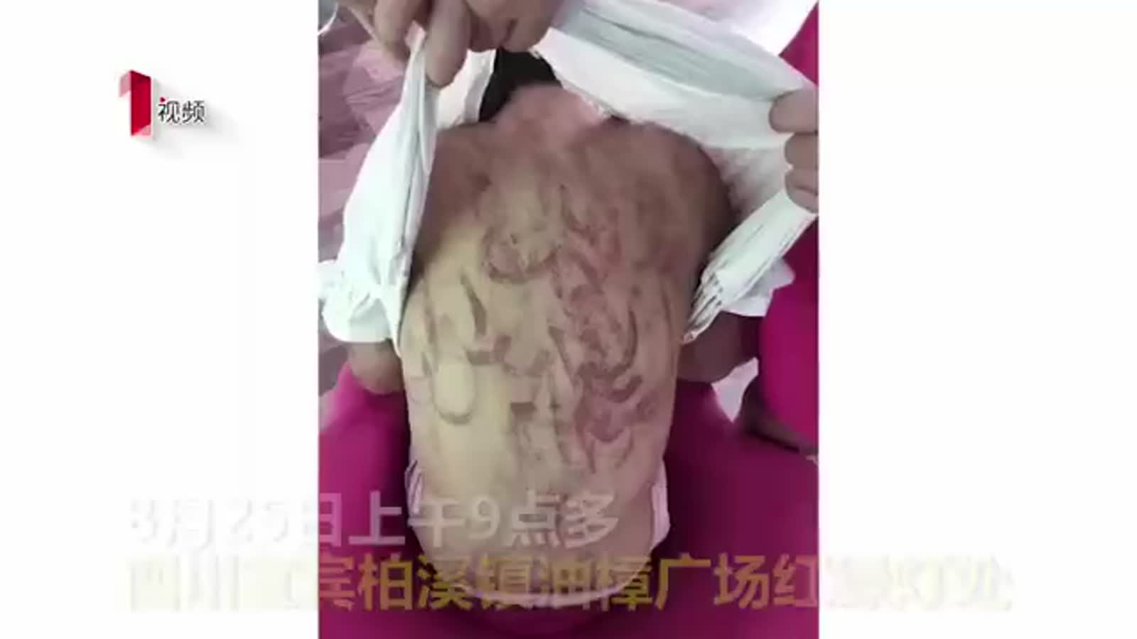 遭继母虐打女童,四岁女童被继母虐打