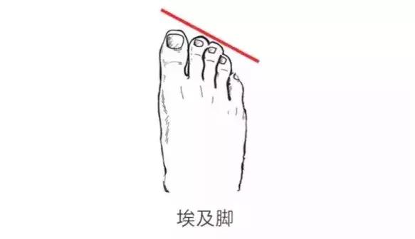 希腊脚罗马脚埃及脚哪个脚第一,埃及脚罗马脚希腊脚哪种脚型好