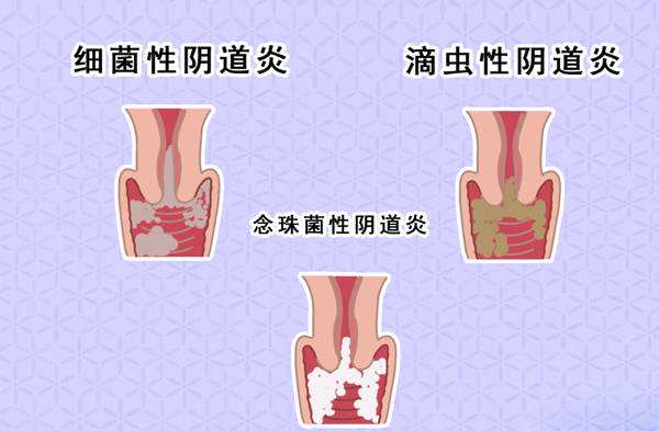 当女人出现这五种表现,身体出现什么症状是不可能怀孕的