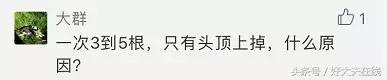 周城医生讲治脱发,周城治疗斑秃