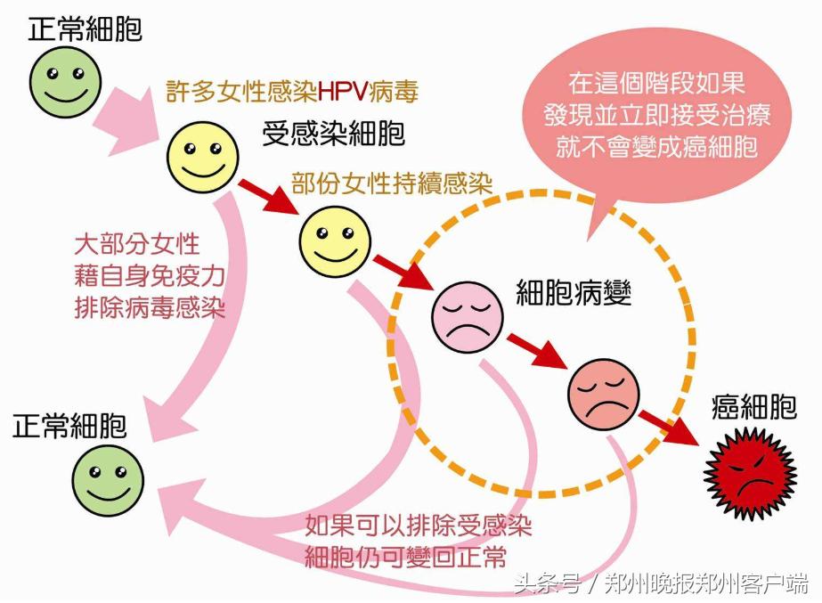 河南能够打九价宫颈癌疫苗的地方,河南哪里能够打宫颈癌疫苗四价