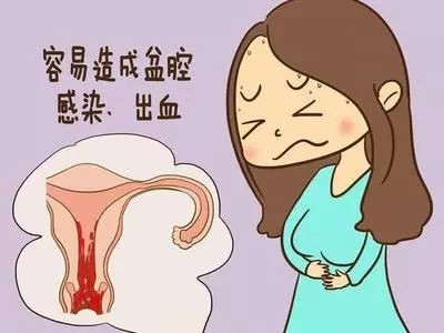 剖腹产后多久能够同房？过早同房的危害自己要知道，避免受罪！