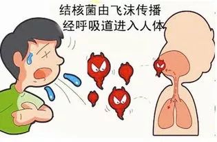药价过高！患者“大闹”结核病盛会，肺结核到底有多难治？