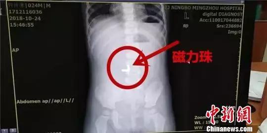 新增17种抗癌药报销比例是多少,山东省抗癌药的报销比例是多少