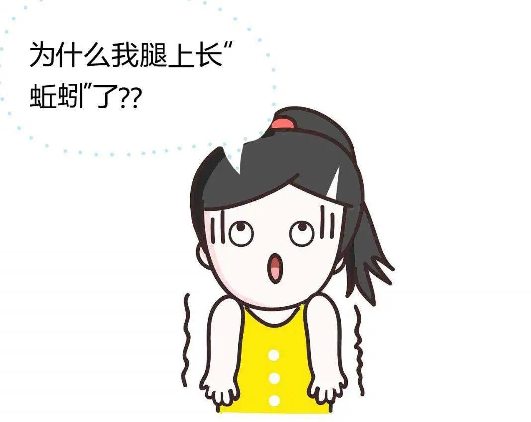 静脉曲张能够用针扎吗,下肢静脉曲张能注射药物治疗吗