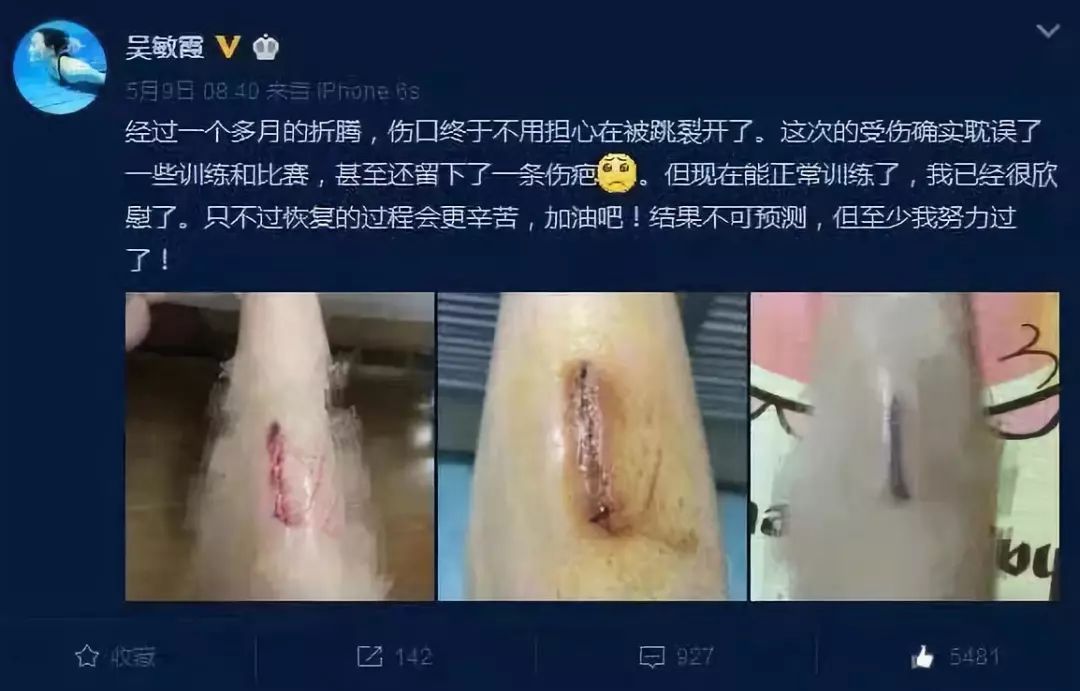 郭晶晶告捷背后的心酸,郭晶晶的真实经历