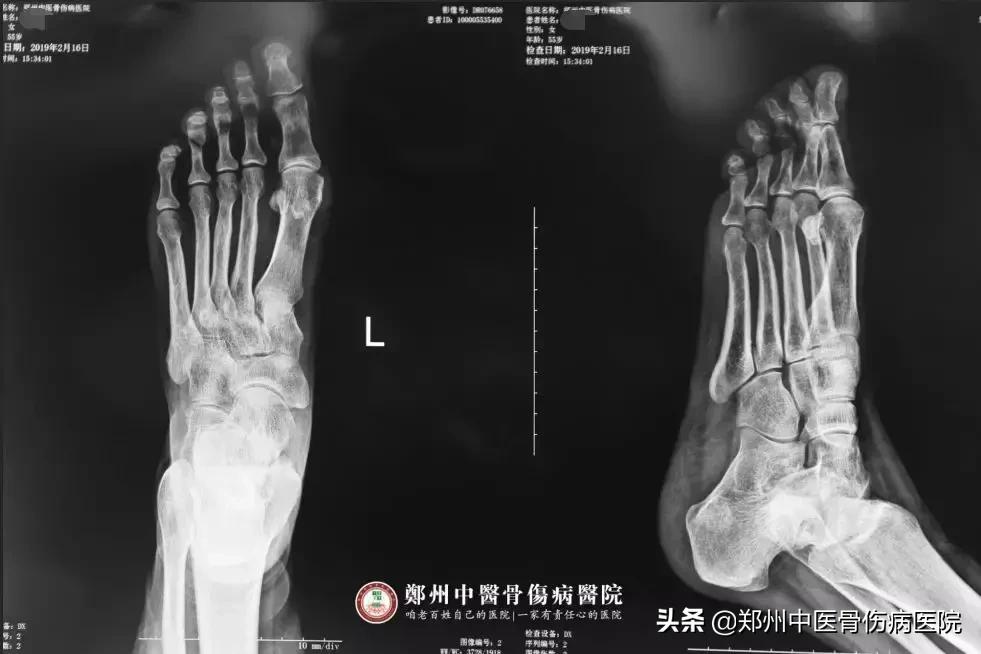 她辗转多家医院治疗未见好转，终在这里告捷解除病痛！