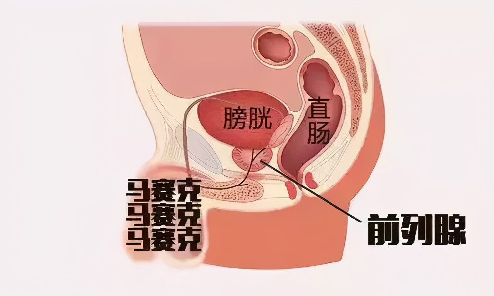 要想不生病牢记这10条,做好4点远离前列腺炎