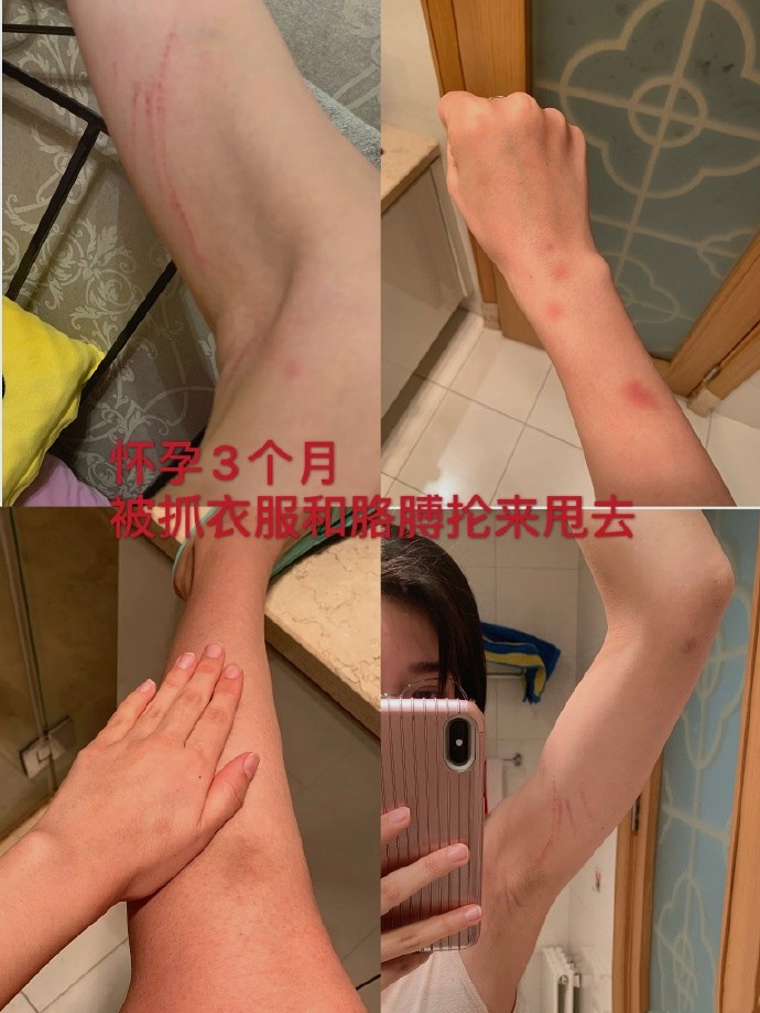 张培萌妻子讲述家暴细节值得推敲,张培萌被控诉家暴