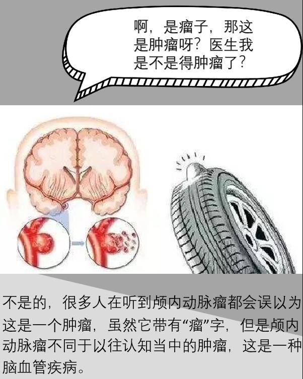 颅内动脉瘤属于主动脉瘤吗严重吗,脑动脉瘤和颅内动脉瘤是一回事吗