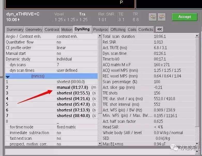 乳腺磁共振亲身经历,磁共振乳腺动态增强扫描全过程