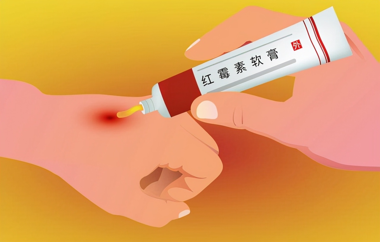 眼部过敏用红霉素软膏能够吗,红霉素软膏用在眼部一次有影响吗