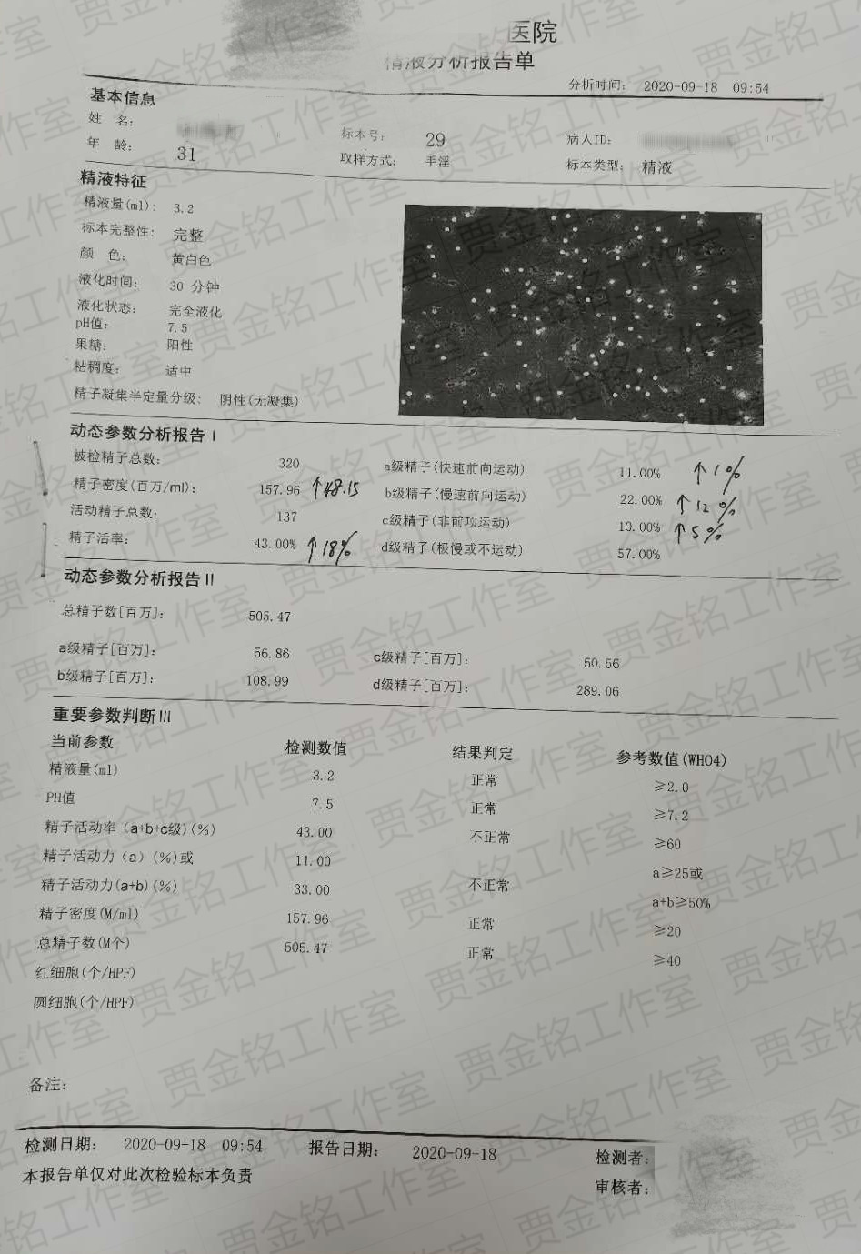 弱精子症患者备孕两个月的治疗精液检查，很开心回家能够要宝宝啦