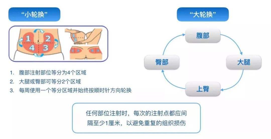注射胰岛素疼痛是怎么回事,胰岛素注射时感到疼痛