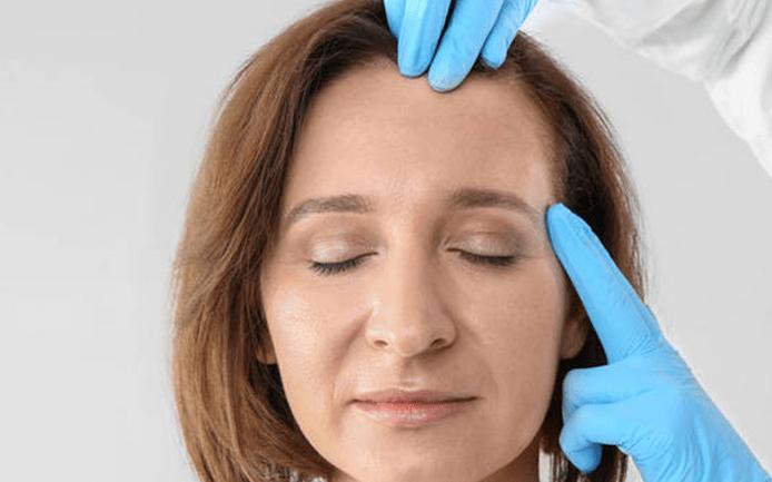 小切口拉皮除皱术合适额头除皱吗,额头缩小大拉皮手术恢复过程