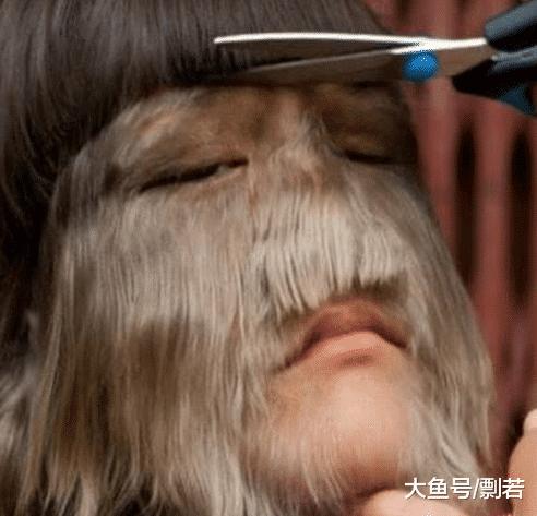 女孩身患“怪病”脸上长毛，男友原本不离不弃，剃发后竟然淡定不了？