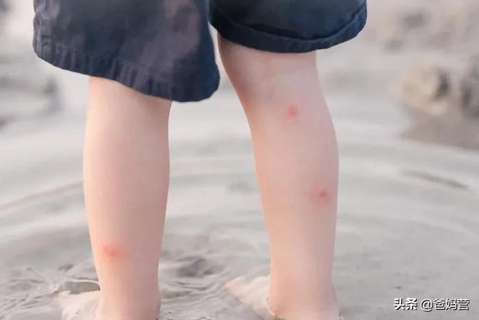 妈妈一拍小孩差点毁容,妈妈拍到孩子的恐怖画面