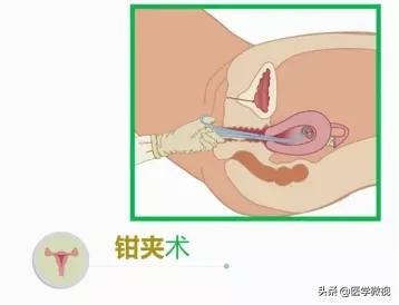 避孕套挤进宅家热销榜前十！怀孕这件事，请做好这2个准备