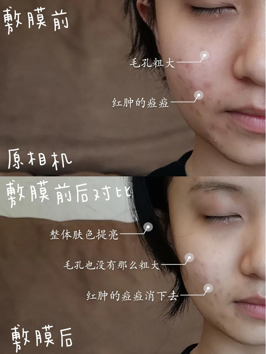 快问快答面膜篇,快问快答护肤问题