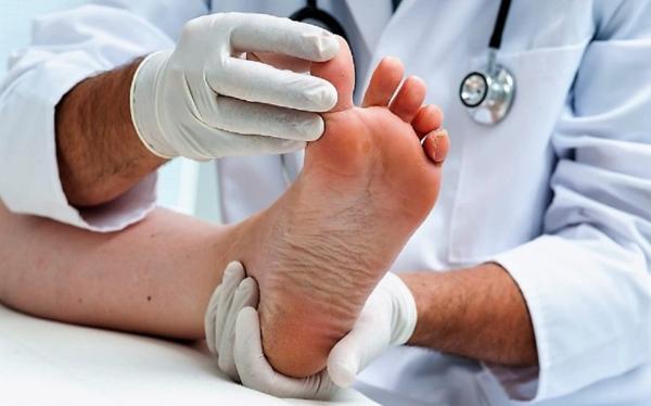 足癣能够泡海水吗,苦参加什么泡脚治足癣