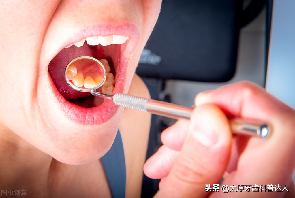 牙颈部楔状缺损牙疼吃什么药,牙颈部龋坏和楔状缺损的差别