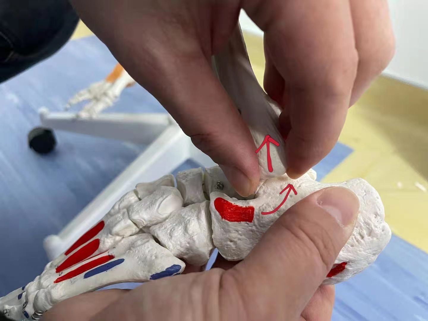 中医正骨手法复位踝关节视频,踝关节脱位中医正骨法