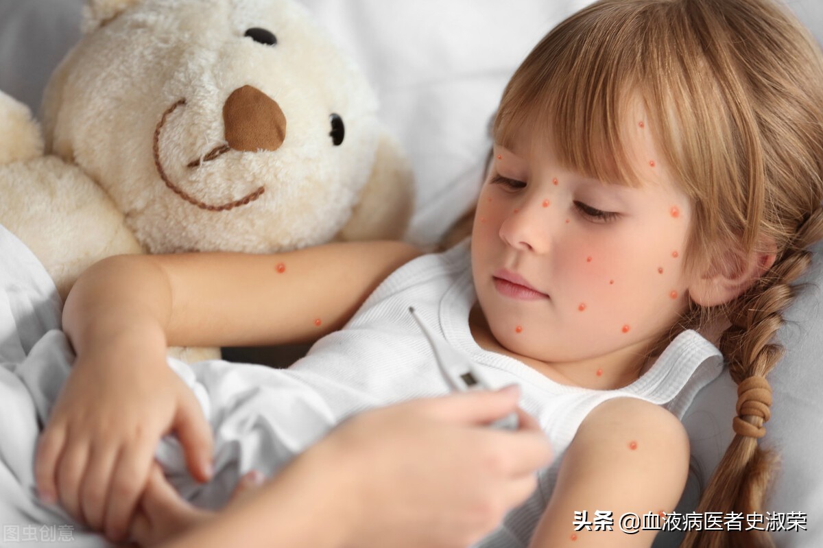 紫癜多长时间没有复发算痊愈,紫癜肾炎痊愈后怎么不复发