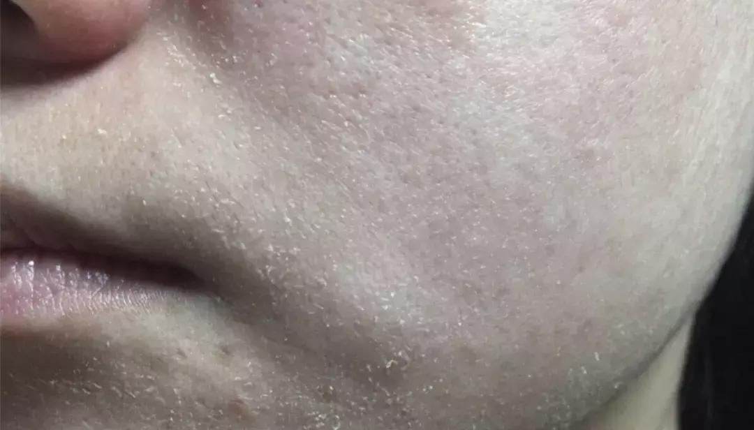 在家就能做的面部spa,在家能够做脸部spa吗