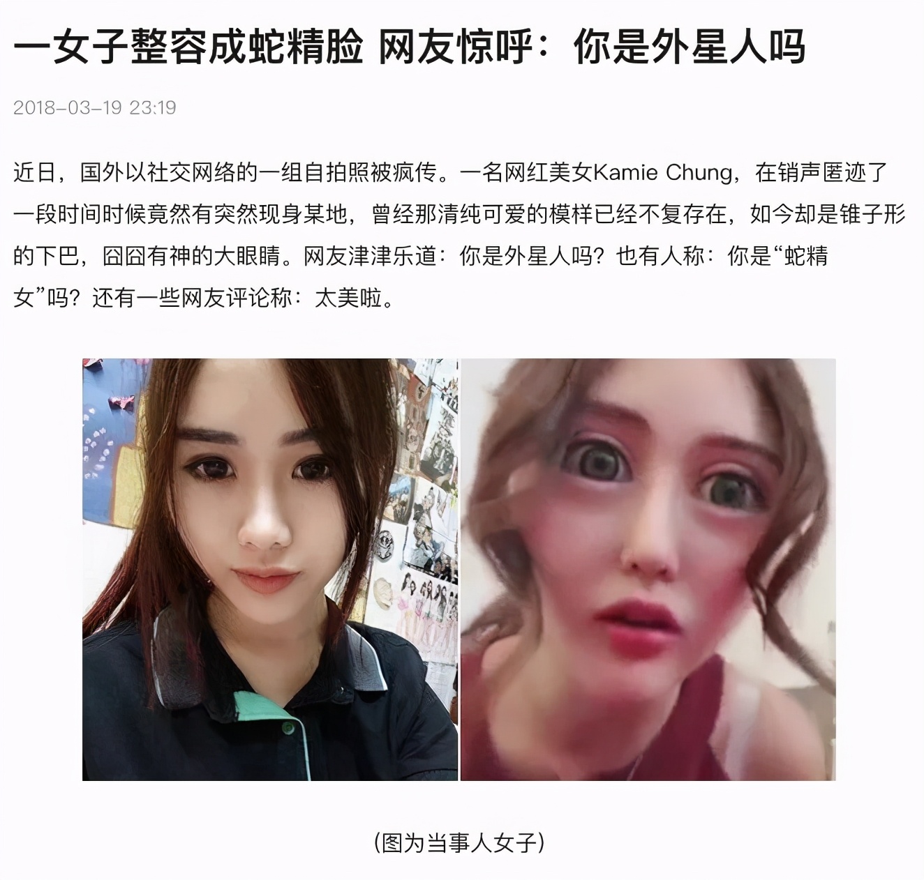 突如其来的满屏焦虑,外貌焦虑是一种病吗