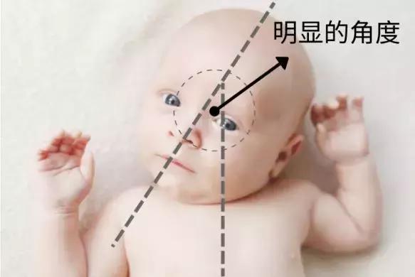 13岁儿童喜欢歪头矫正最佳方法,孩子写字歪头有什么工具能够矫正