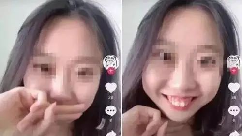 带你了解超详细的牙齿矫正过程,牙齿矫正全过程看完你就知道