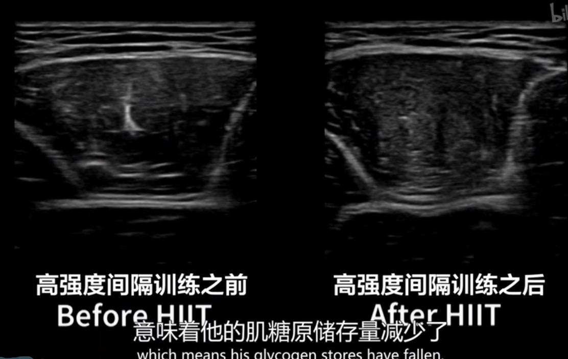 有没有关于跑步的纪录片,跑步纪录片高清视频