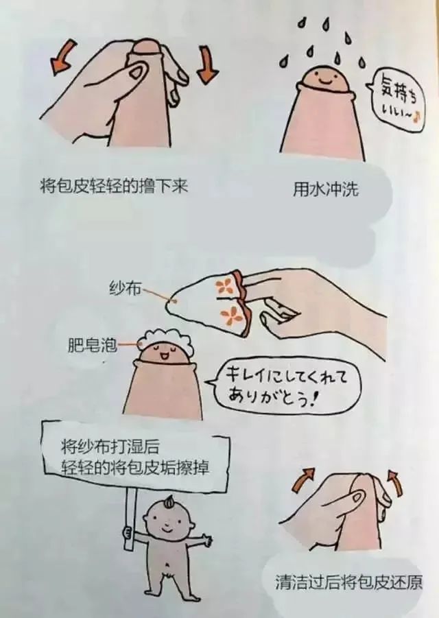 割包皮有第二根半价吗,割包皮有几率失误吗