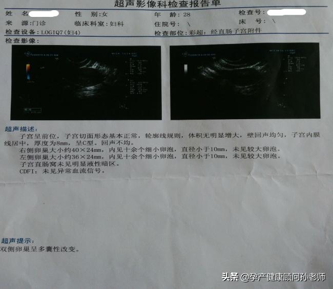 多囊好孕经验,多囊医生指导怀孕告捷率有多高