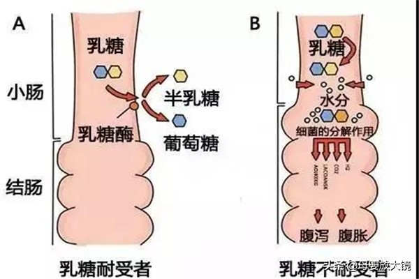 腹泻宝宝该怎么吃乳糖酶和益生菌,腹泻奶粉转奶要服用乳糖酶吗