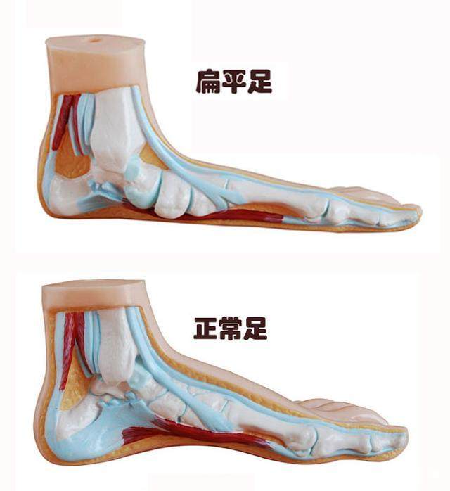 穿人字拖会影响腿型吗,穿人字拖对脚有伤害吗