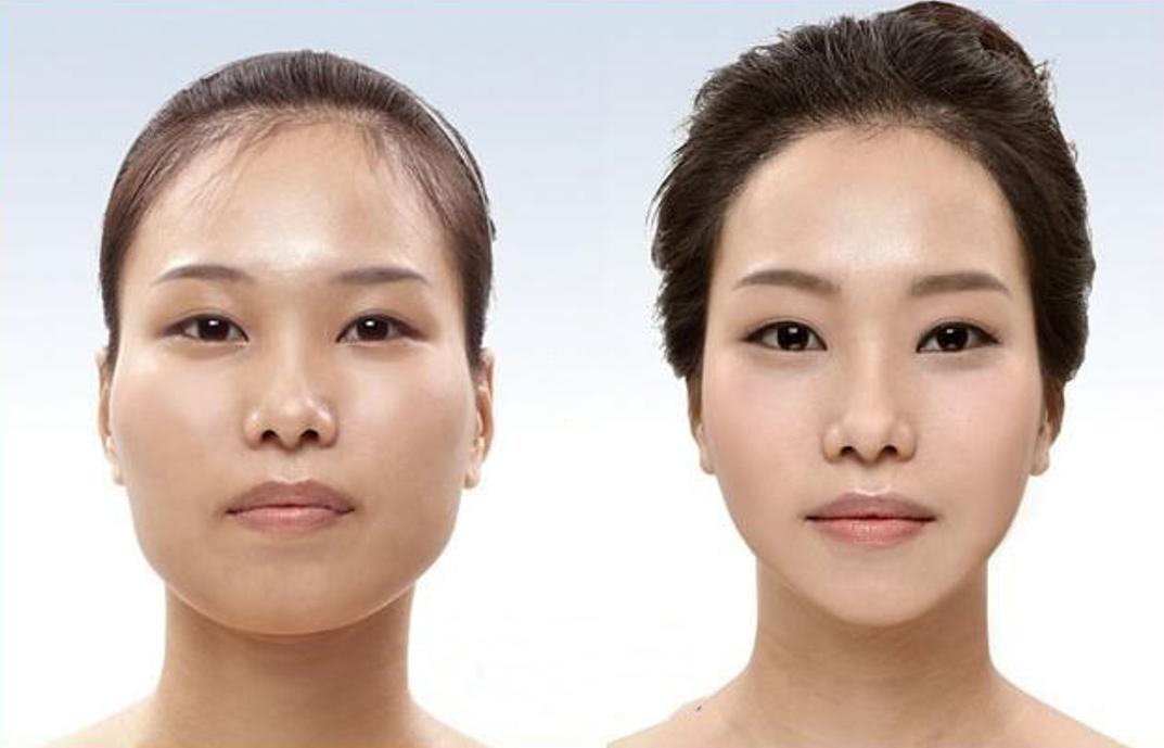 整容最告捷的美人,整容最告捷的13个人