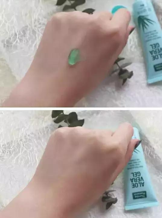 有痘痘女生应该怎样自信,抗痘痘的最佳方法