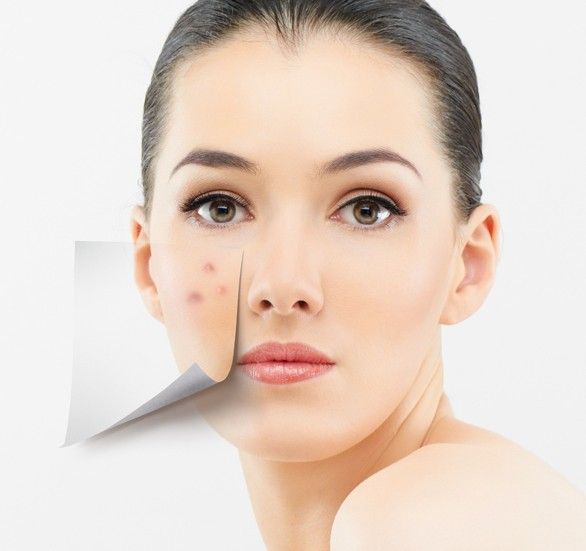 爱出油，上粉底还爆皮，这种奇葩皮肤怎么救？