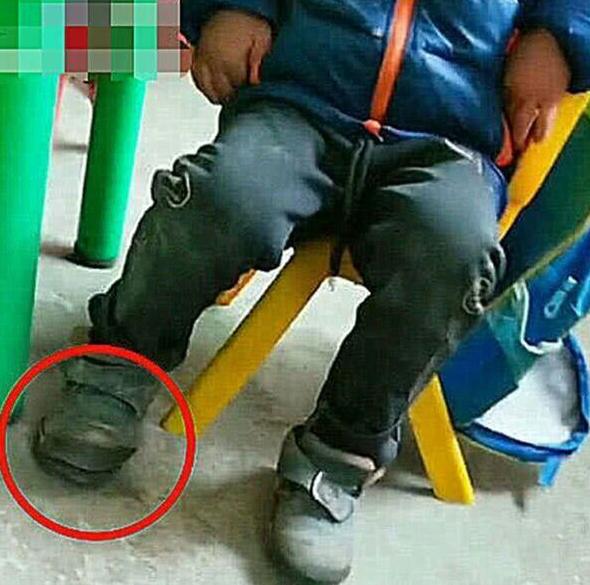 小朋友上课抖腿,孩子上课故意抖动腿怎么回事
