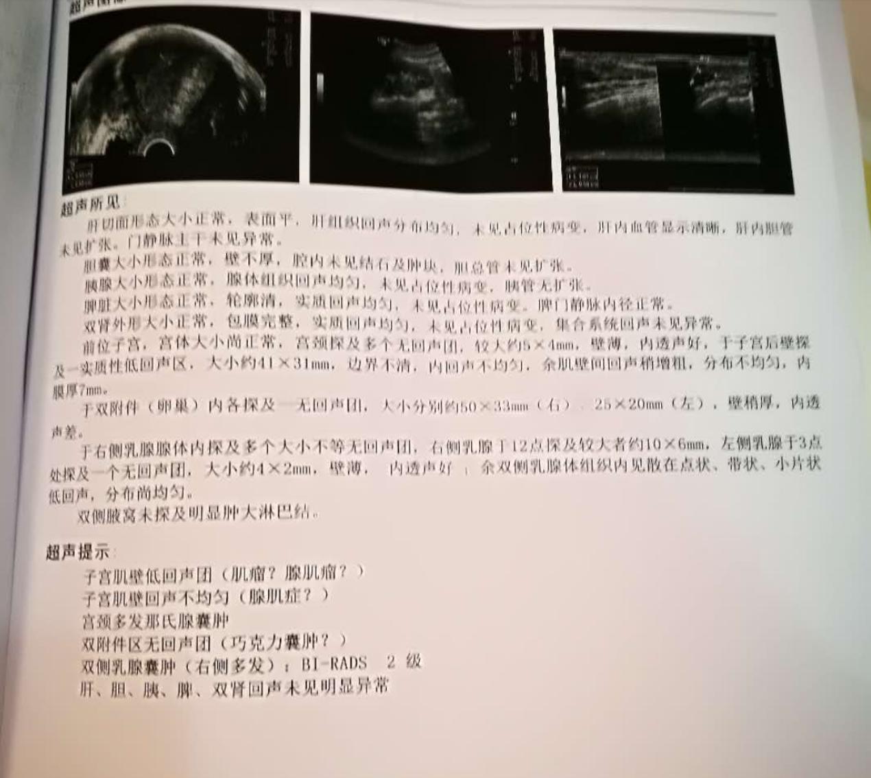 子宫腺肌症能够吃妇科再造丸吗,妇科子宫腺肌症最佳治疗方法